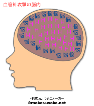血管針攻撃の脳内イメージ 脳内メーカー